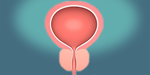PROSTAT
