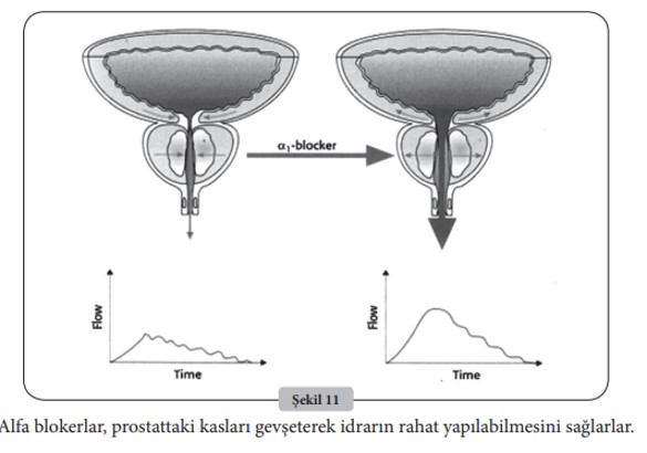 Resim3