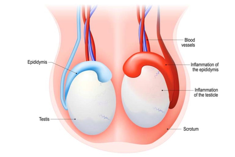 penis 9 Resim1 a