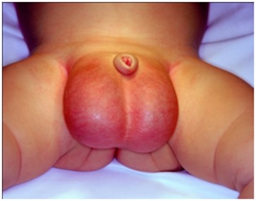 penis 6 Resim1 a